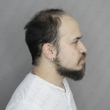 Öncesi